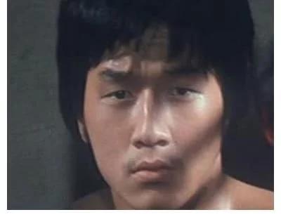 探尋小巷中的美麗秘密，割雙眼皮的價格是否昂貴？